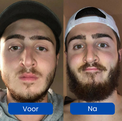 HairGrowth – Ondersteunt een gezonde haarbeleving