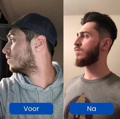 HairGrowth – Ondersteunt een gezonde haarbeleving