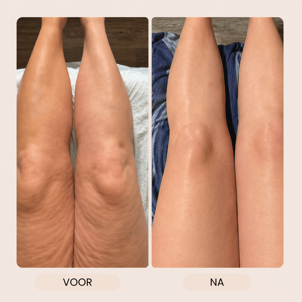 LymphGlow - Lichaamsborstel voor detox, verzorging & glow