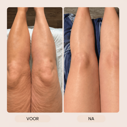 LymphGlow - Lichaamsborstel voor detox, verzorging & glow