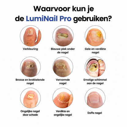 WellBetter LumiNail Pro