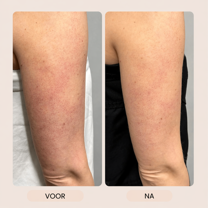 LymphGlow - Lichaamsborstel voor detox, verzorging & glow